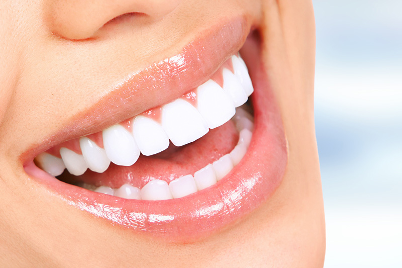 Cosmetic Dentistry in San Francisco